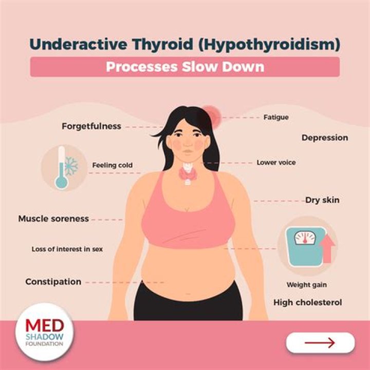 Can Hyperthyroidism be passed down?