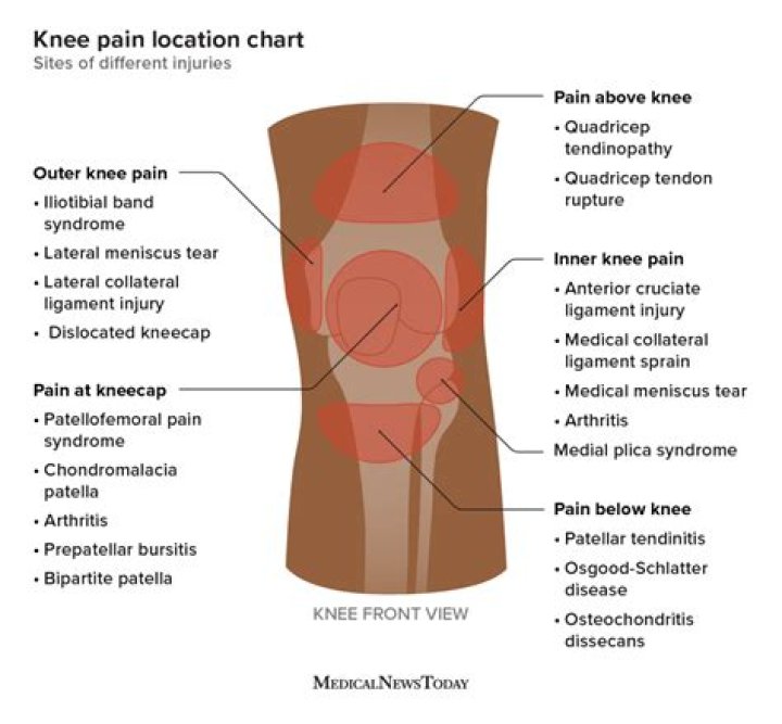 How do I know if I have a bad knee injury?