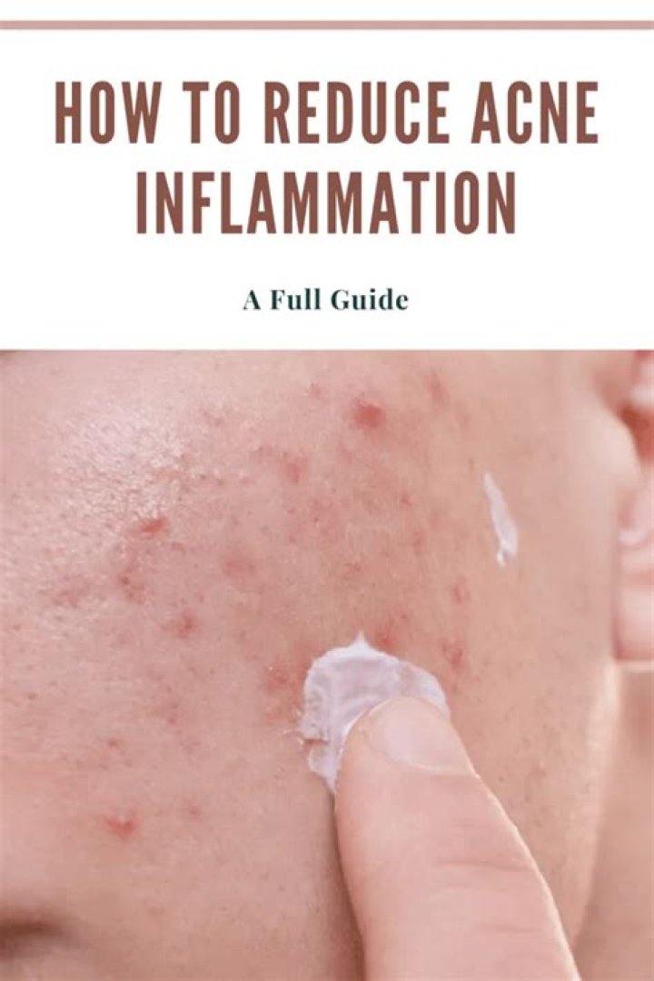 How do you reduce acne inflammation?
