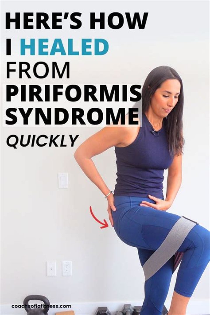 How long does it take for piriformis syndrome to heal?