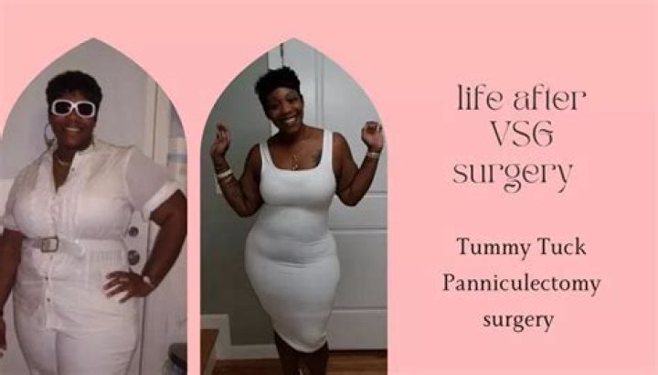 How much weight can you lose with a Panniculectomy?