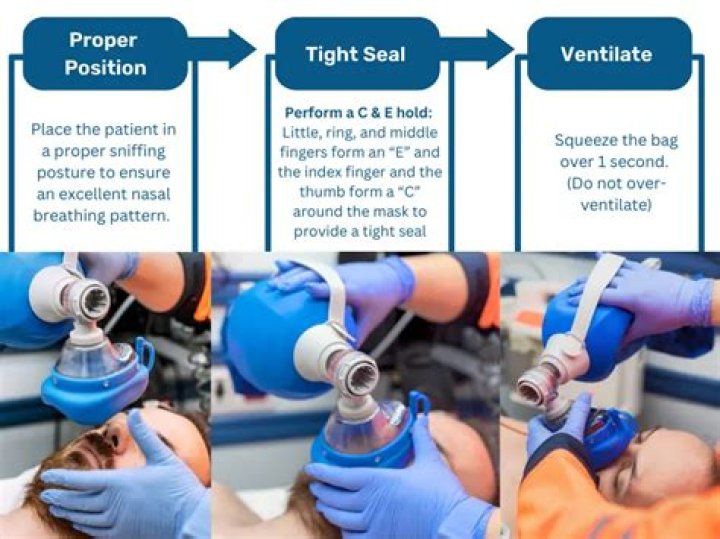 How often do you squeeze the bag to properly ventilate a patient?