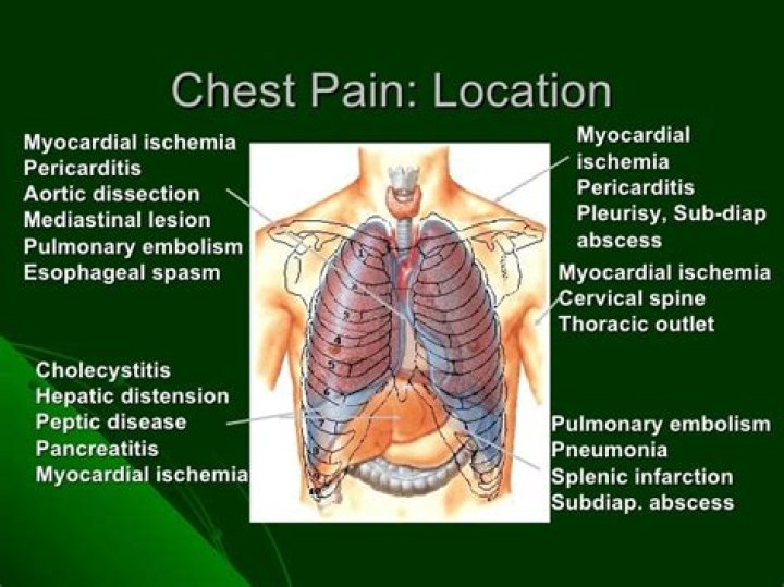 Is pleurisy pain constant?