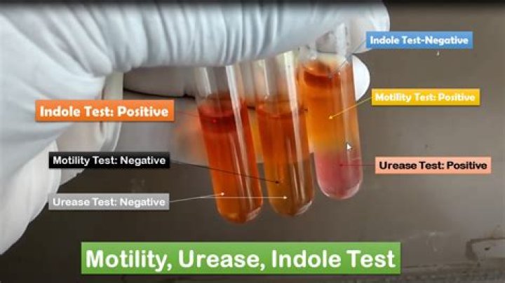What media is used for indole test?