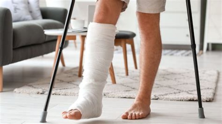 What to do if you find a deer with a broken leg?