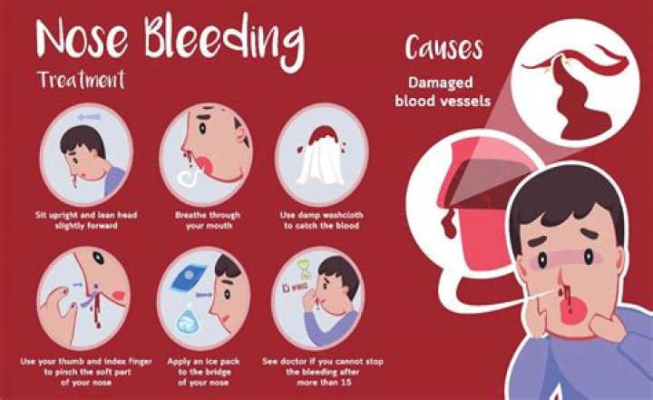 Why do I keep blowing my nose?